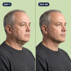 Milk Thistle Liver Detox hero image 12